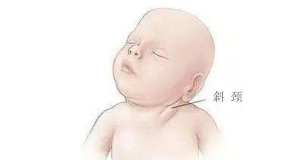 孕期朝一个方向睡,宝宝出生后会成"歪脖子"?孕妈尽管放心睡