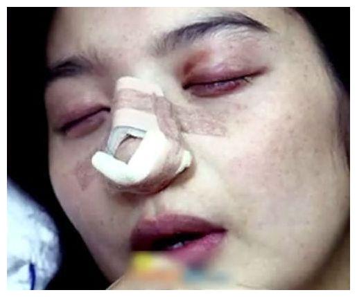 她结婚13天就离婚,被丈夫砍掉手指踢掉胎儿,星途就此葬送