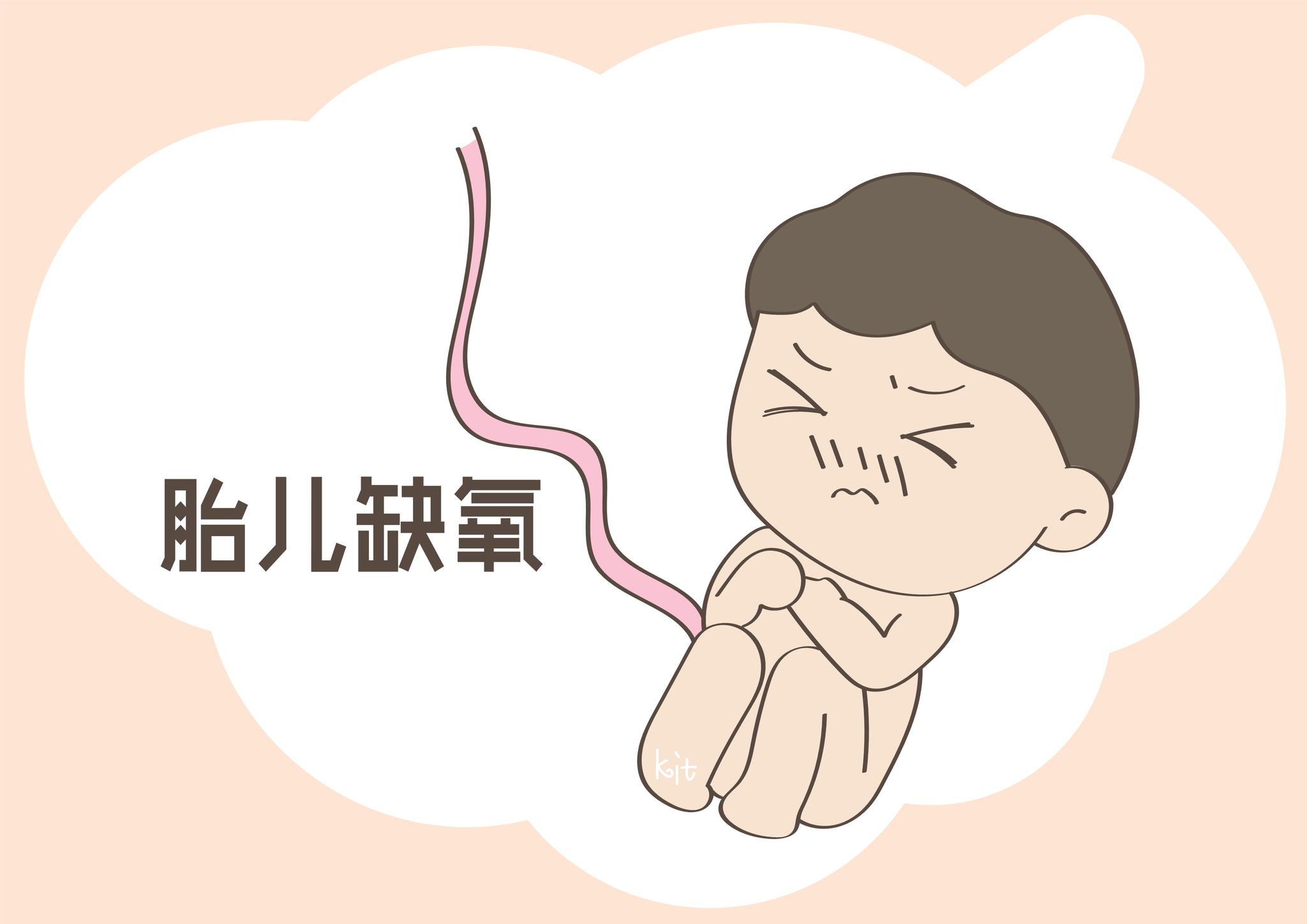 胎儿如果缺氧,会出现这几个表现,宝妈们长点心