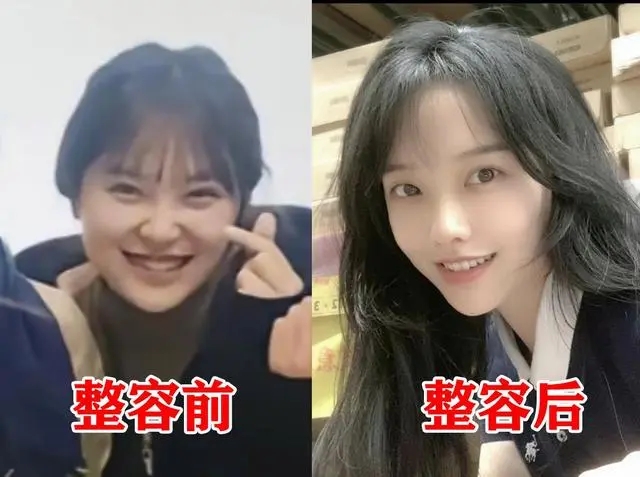 这一次“挖呀挖”黄老师被黑得太惨,旧照被曝,被指责整容换脸休闲区蓝鸢梦想 - Www.slyday.coM 这一次“挖呀挖”黄老师被黑得太惨,旧照被曝,被指责整容换脸休闲区蓝鸢梦想 - Www.slyday.coM