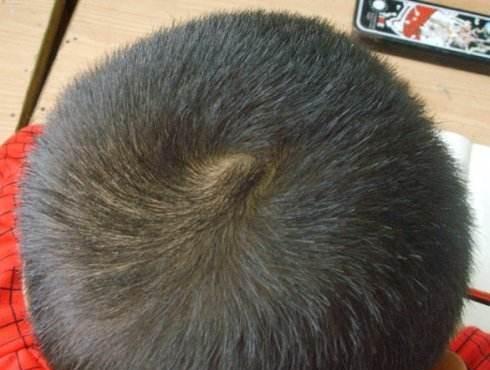为啥有的孩子头上会了2个旋?究竟代表了什么?