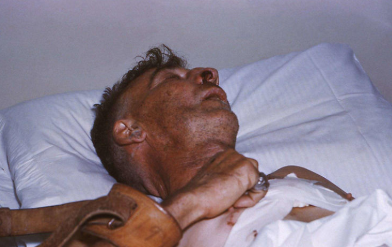 被狗咬伤后,狂犬病发作死亡率高,为什么难以治愈?