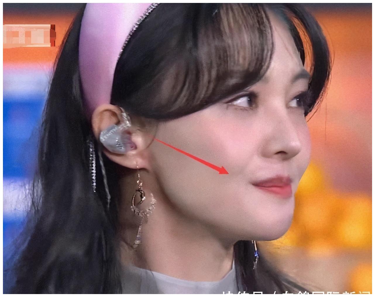 郑爽被超清镜头怼脸拍,鼻侧又现新"疤痕"?脸部肌肉僵硬……__财经头条