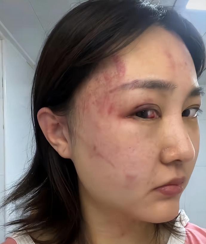 34岁女星被家暴满脸伤痕男方回应其出轨忍无可忍聊天记录为证