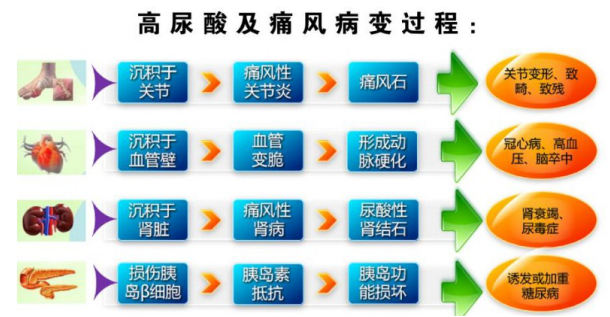 坚持每天吃,尿酸悄悄溜走,痛风也没了|尿酸|痛风|高尿酸_新浪新闻