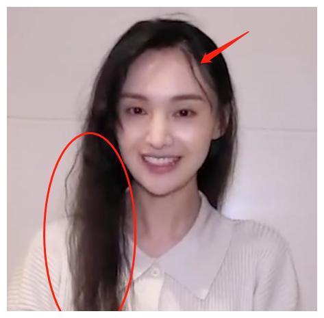 郑爽素颜憔悴,头发稀疏像秃顶,发量少得可怜