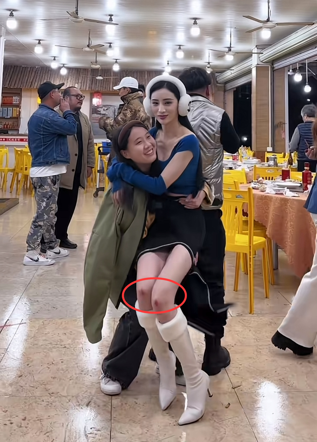 演员吴春怡膝盖摔伤,伤口红肿让人心疼,助理照顾她机场坐轮椅