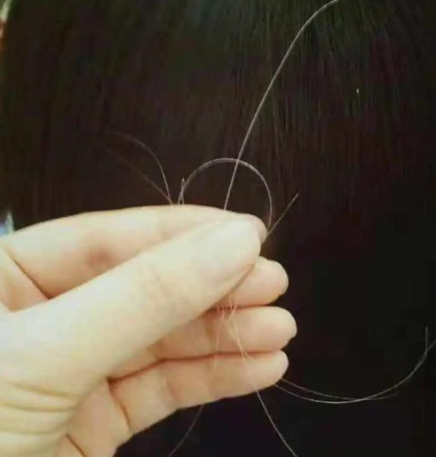 人一过30岁,为什么头上白头发越来越多?