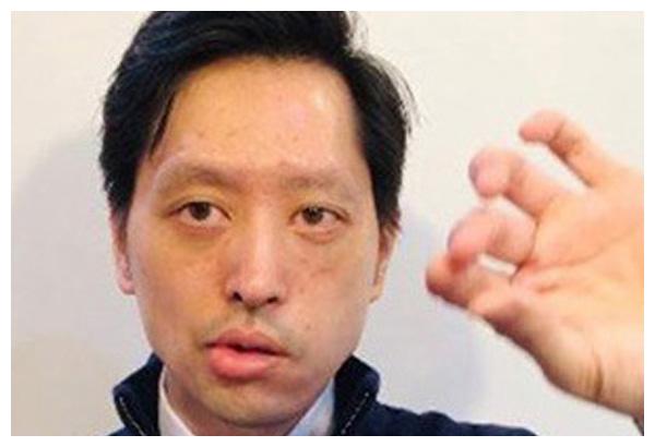 泰国三王子一脸病容病到嘴歪眼斜拉玛十世却对他不闻不问