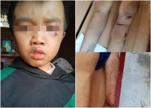 江西12岁男童遭虐待致死,被捕父母曾打算偷埋尸体掩盖罪行