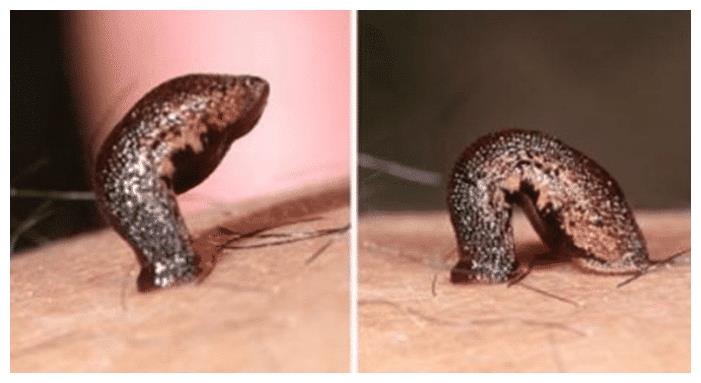 不小心生吞了蚂蟥,它会在肚子里生存下去吗?原来如此.