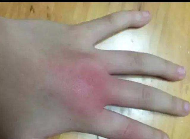 主播为赚钱直播吃壁虎壁虎和其尿液到底有毒吗网友还是老实