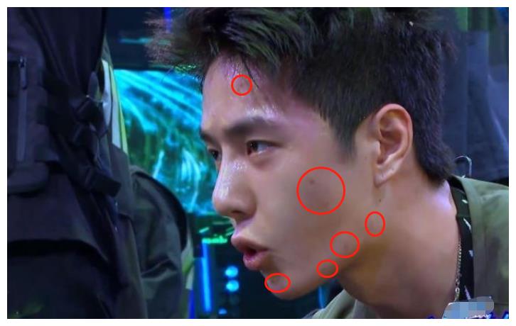 王一博街舞头发炸毛了离开滤镜后脸上痘痘意外抢镜