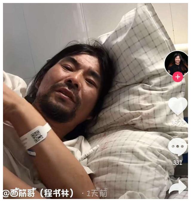 面筋哥近况曝光,面色暗黄显憔悴,插呼吸管躺病床身形消瘦惹人心疼