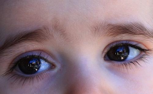 宝宝总爱眨巴眼睛?可能是睫毛倒长了,这5点宝妈要注意!