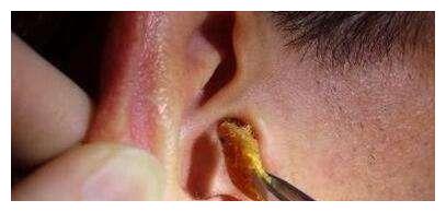 并说了一句令王女士后怕不已的话,医生表示随后打开手电筒一看,身上的