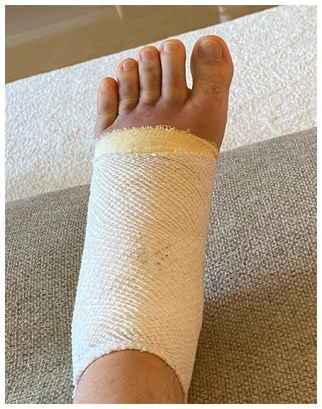 59岁庾澄庆意外受伤脚肿似肉包行动艰难拄双拐模样憔悴