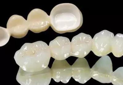 牙齿修复的全冠材料和优缺点