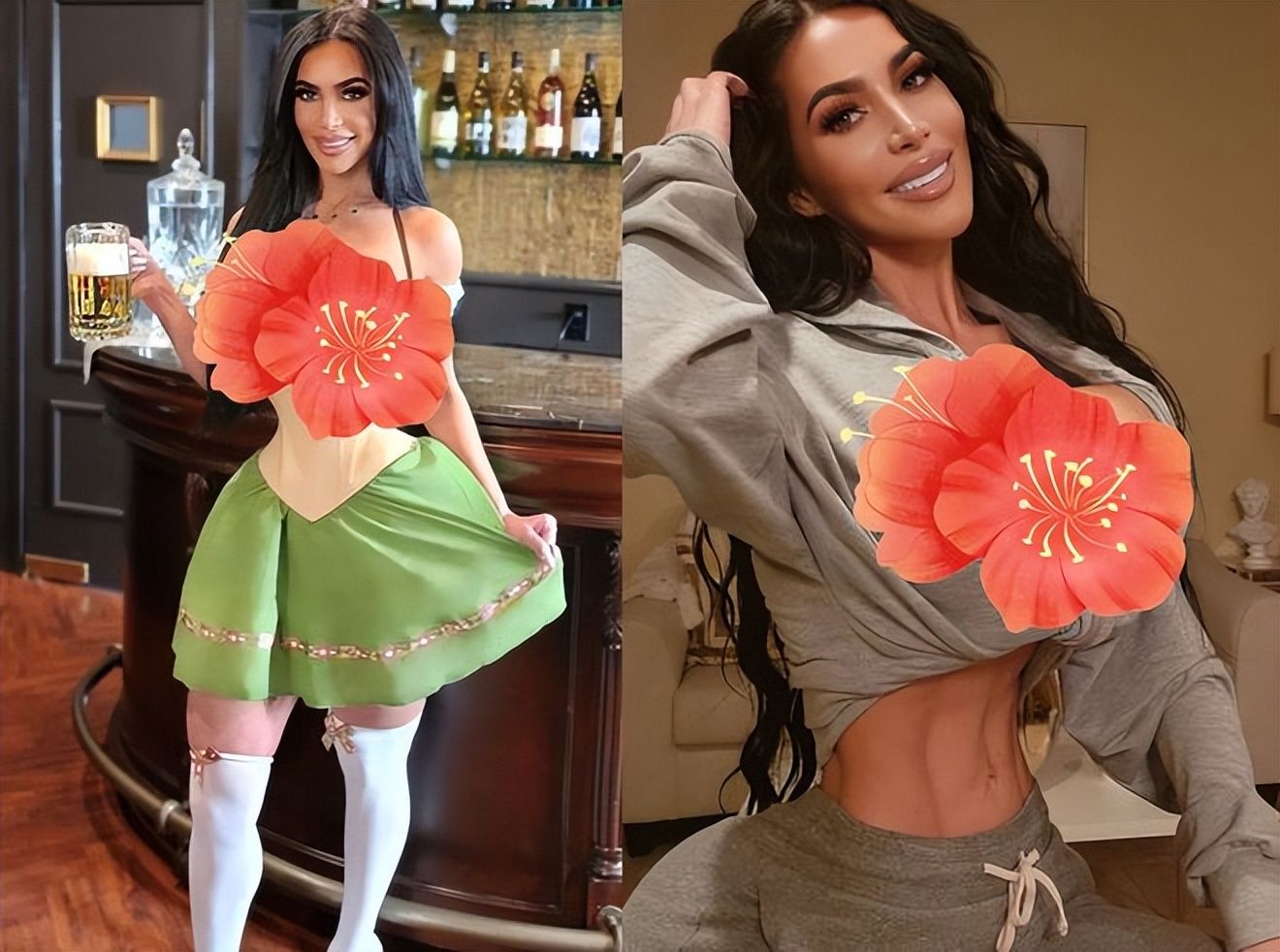 卡戴珊模仿者过度整容意外离世,沙漏身材太夸张