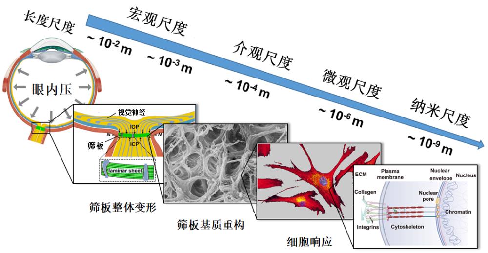 青光眼致病机理——筛板的跨尺度生物力学研究