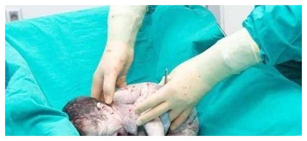 刚出生的婴儿到底是什么样子呢来一起看看婴儿出生的那一刻吧