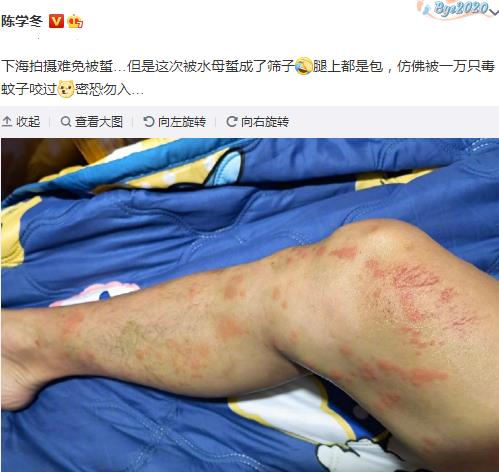 十八线男艺人拍戏受伤晒照诉苦被网友怒怼再不去医院就愈合了