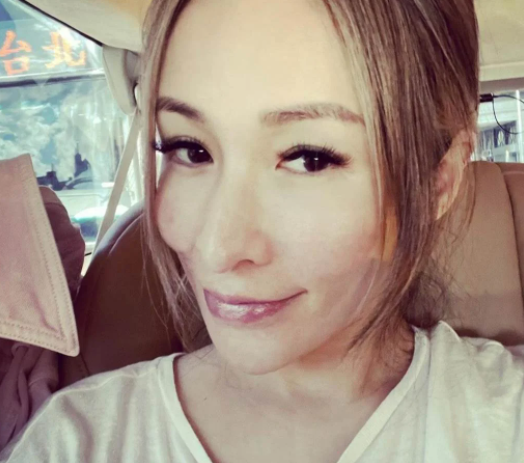 42岁萧亚轩近照曝光,脸上伤疤明显,素颜现身心态超好|萧亚轩|近照曝光