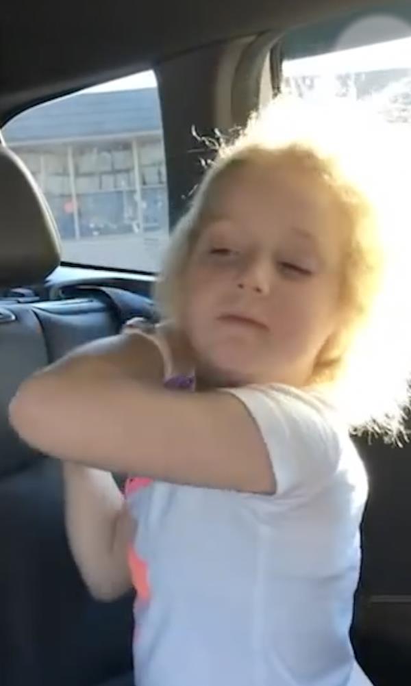 10岁女孩患难梳头发综合征，拥有爱因斯坦同款发型休闲区蓝鸢梦想 - Www.slyday.coM