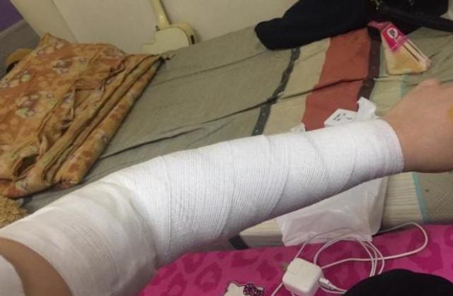 就朝着网友去了,把网友的胳膊挠了好多下网友赶紧去医院找医生包扎