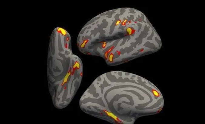 新冠后遗症新发现：病毒或加速大脑萎缩、或使人提前衰老1休闲区蓝鸢梦想 - Www.slyday.coM