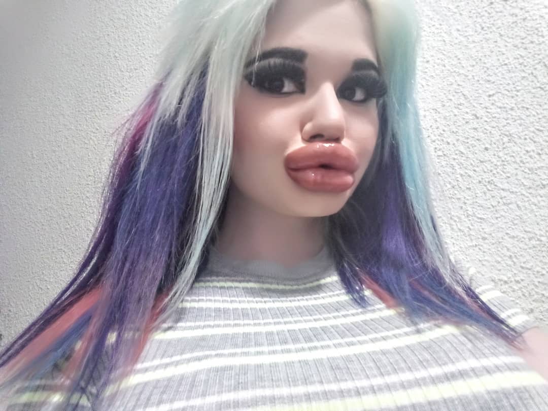 来自保加利亚的andrea ivanova从2018年开始整形,此后花费了数千英镑