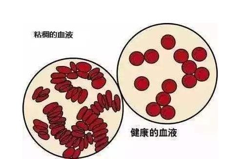 晨起头晕、午后犯困?可能是体内血液粘稠,5个方法帮你改善!休闲区蓝鸢梦想 - Www.slyday.coM 晨起头晕、午后犯困?可能是体内血液粘稠,5个方法帮你改善!休闲区蓝鸢梦想 - Www.slyday.coM