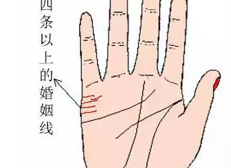 有四条婚姻线预示着什么