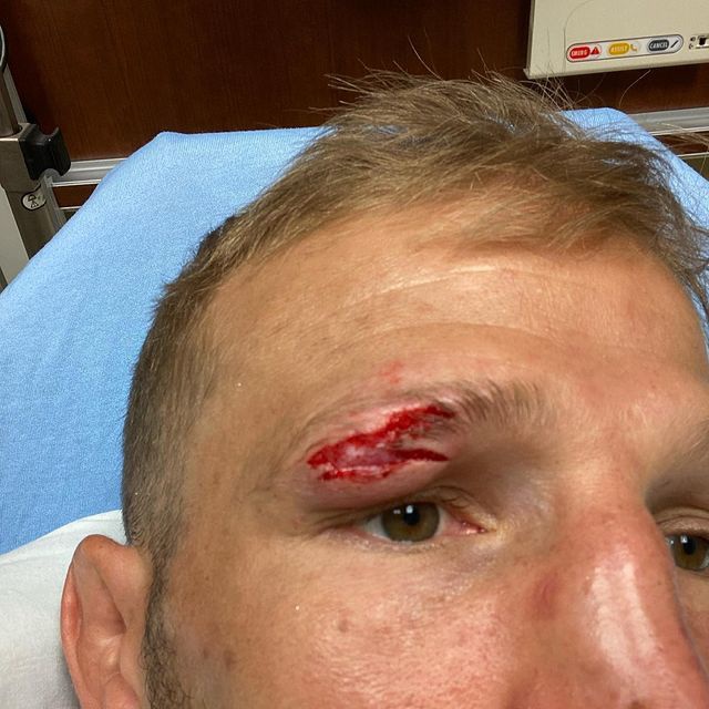 前ufc冠军tj迪拉肖因伤退出5月9日比赛