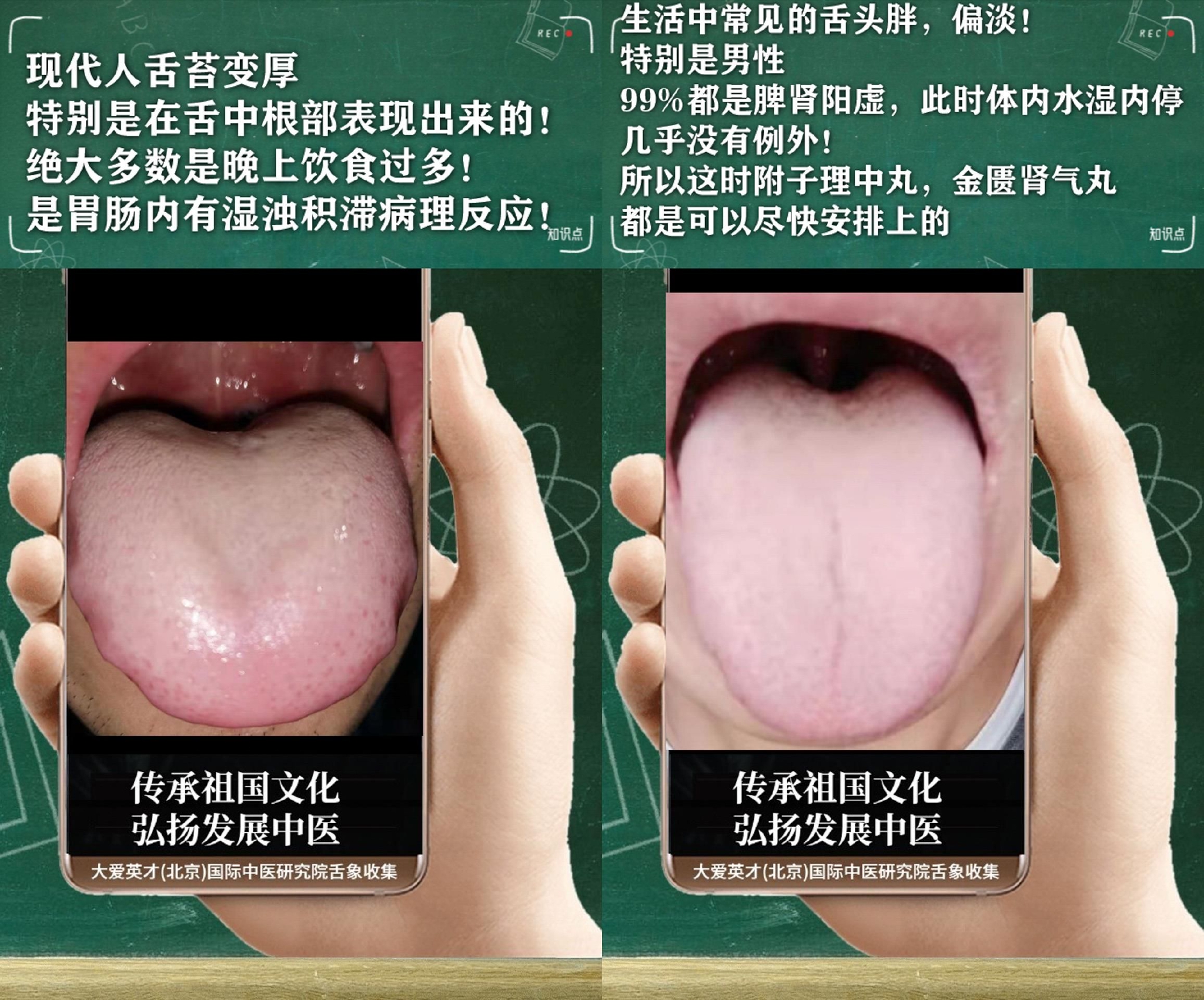 舌诊医案:常难过、易怒心烦、经常咳嗽、反复不断很受困扰休闲区蓝鸢梦想 - Www.slyday.coM 舌诊医案:常难过、易怒心烦、经常咳嗽、反复不断很受困扰休闲区蓝鸢梦想 - Www.slyday.coM