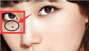 地方就是泪堂痣,不管是在眼头或者下眼睑,这些范围的痣都被称为流泪痣