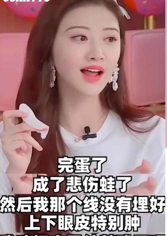 景甜的脸怎么了33岁看上去像40岁面部肿胀玻尿酸打太多