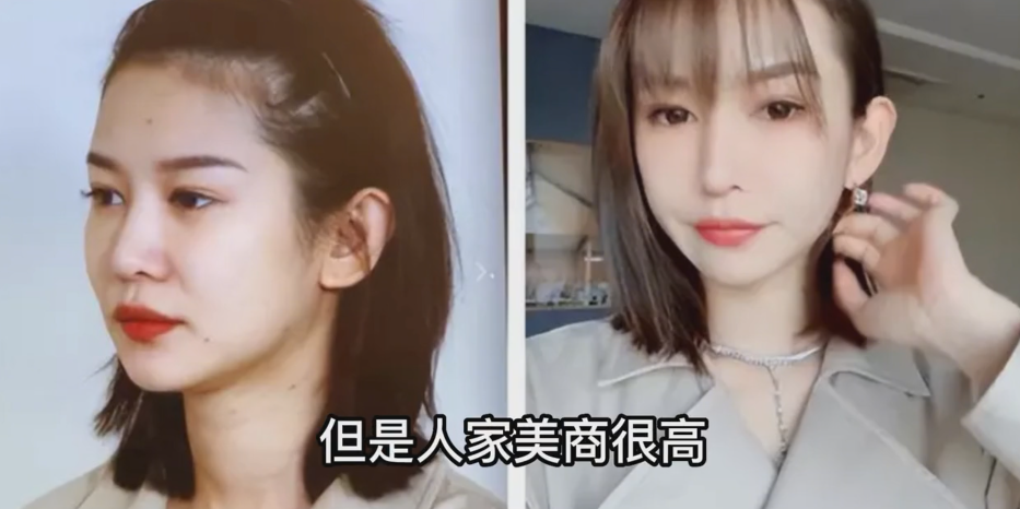 14年美容史，网红湾湾整容前后对比，曾经诸多言论，让人忧心三观|红湾|整容|双眼皮_新浪新闻