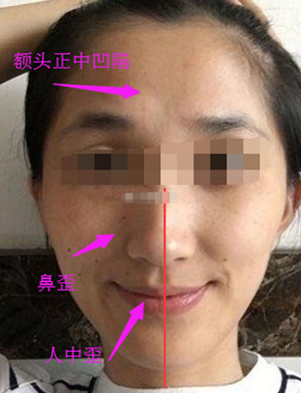 你这是典型的甲字脸,性格内敛,在感情方面,对感情充满了想象,但是会因