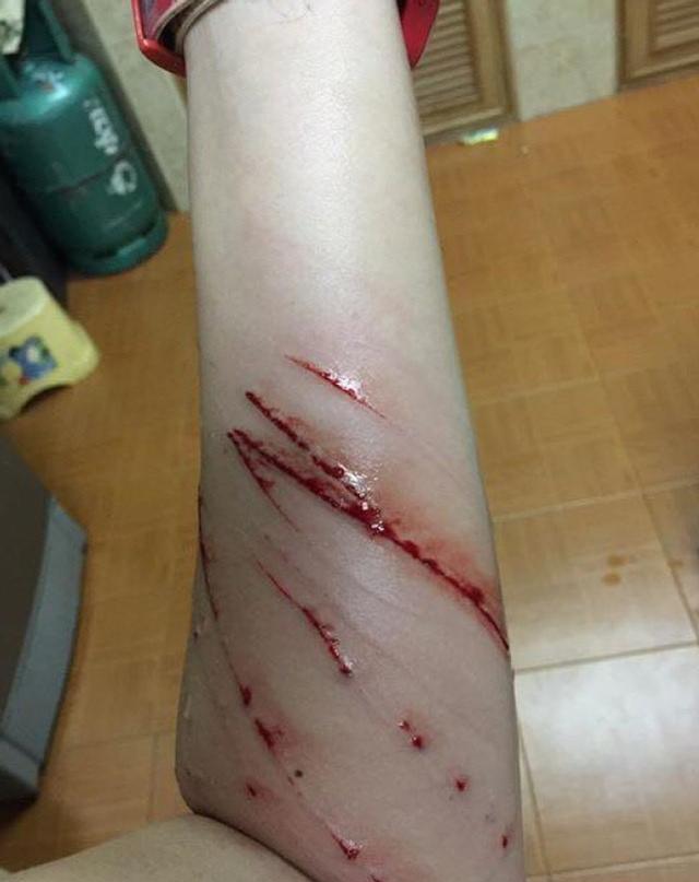 猫咪突然异常暴躁,主人好心安慰却被抓伤,更扎心的还不止于此__财经