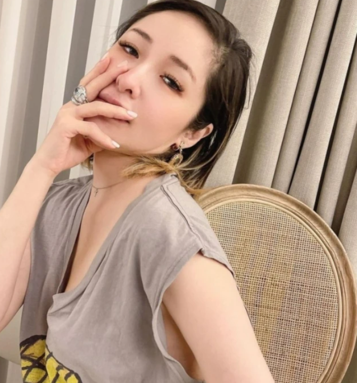 42岁萧亚轩近况曝光晒素颜照曝脸上伤疤网友力挺依然是女神