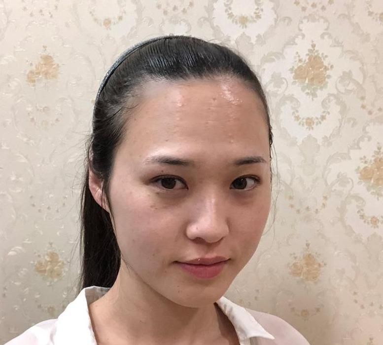 天生的发际线高,秃头逆袭成女神只差设计一个完美的发际线