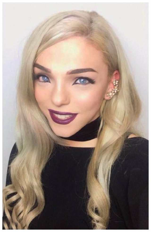 小伙变性成女人后不满意,后来又花23万整8次只为更像女人|变性|整容