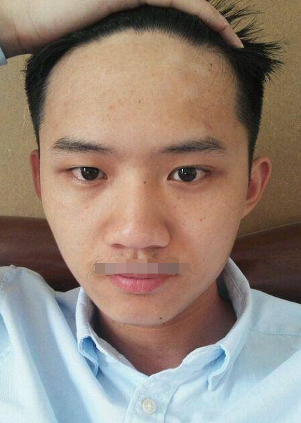 额头宽阔饱满头脑聪明智慧开通能够得贵人相助