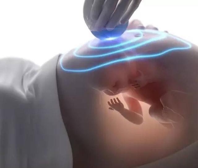 孕妇为什么会出现胎停是什么原因造成的 孕妇要怎么预防胎停介绍