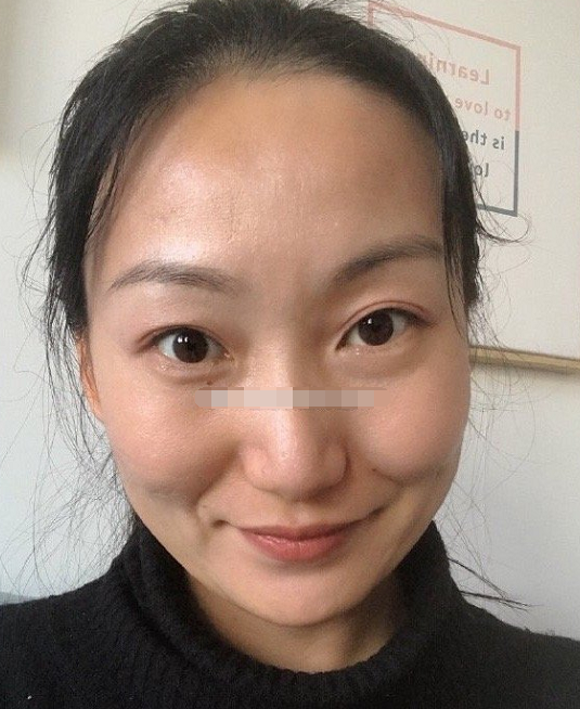 额头宽阔饱满头脑聪明智慧开通能够得贵人相助