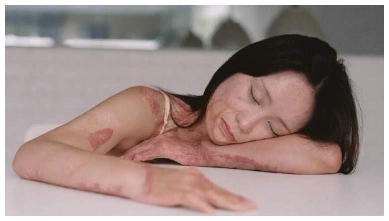 周岩因拒绝富二代追求花季少女被烧伤毁容富二代结局如何