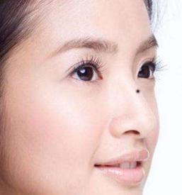 鼻子上长痣到底好不好?