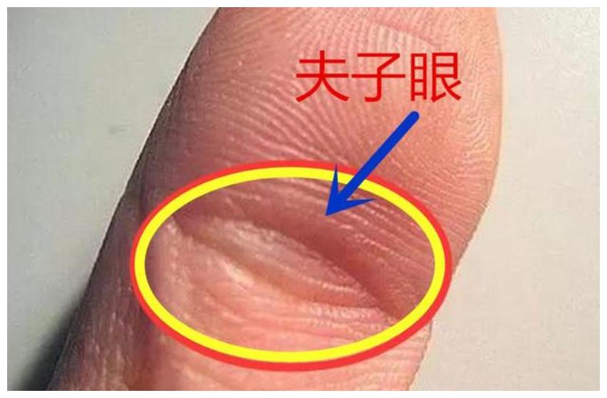 手相符号夫子眼凤眼纹的解释