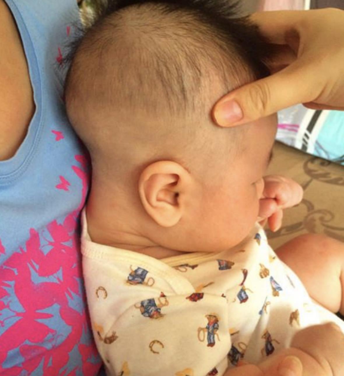 宝宝头型矫正|舟状菱形头矫正8个月变小圆头！ - 知乎